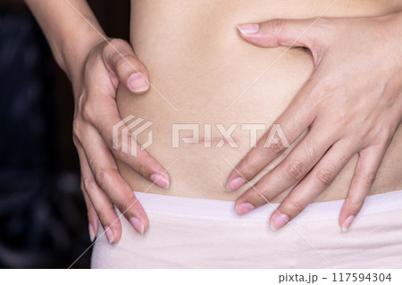 Scar on abdomen after removal appendicitis, Scar on human woman skin keloid from appendectomy, Woman showing on her stomach with scar. Scar on abdomen after removal appendicitis, Scar on human woman skin keloid from appendectomy, Woman showing on her stomach with scar. 117594304