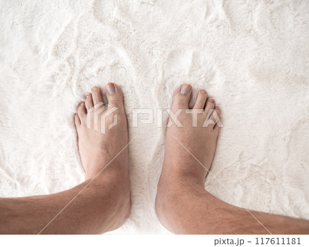 Male foot with long ugly nails Male foot with long ugly nails 117611181