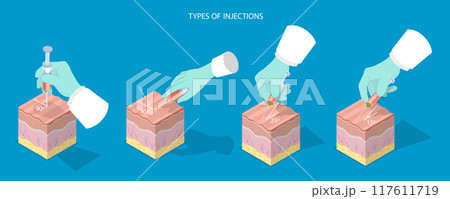 3D Isometric Flat Vector Illustration of Types Of Injections, Basic Medical Study 117611719