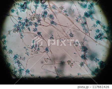 細かい花びらのように広がるカビの胞子の顕微鏡写真 細かい花びらのように広がるカビの胞子の顕微鏡写真 117661426