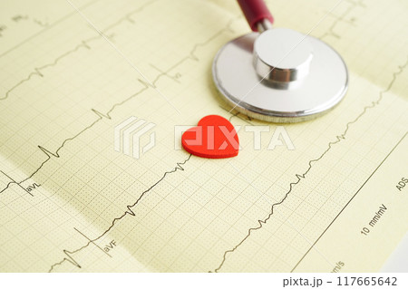 Stethoscope on electrocardiogram (ECG), heart wave, heart attack, cardiogram report. Stethoscope on electrocardiogram (ECG), heart wave, heart attack, cardiogram report. 117665642