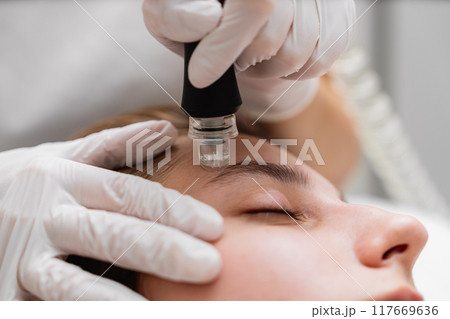 Microdermabrasion treatment session at a skincare clinic for facial rejuvenation Microdermabrasion treatment session at a skincare clinic for facial rejuvenation 117669636