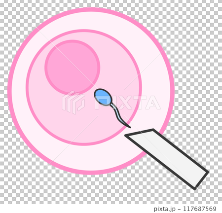 Illustration of artificial insemination for infertility treatment 117687569