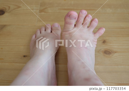 40代女性の足 40代女性の足 117703354