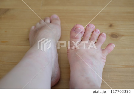 40代女性の足 40代女性の足 117703356