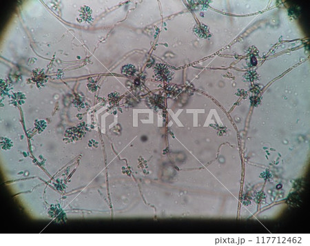 黒かびの細い菌糸と分生子 117712462