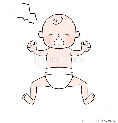 発疹 オムツをした赤ちゃんのイラスト 発疹 オムツをした赤ちゃんのイラスト 117732975