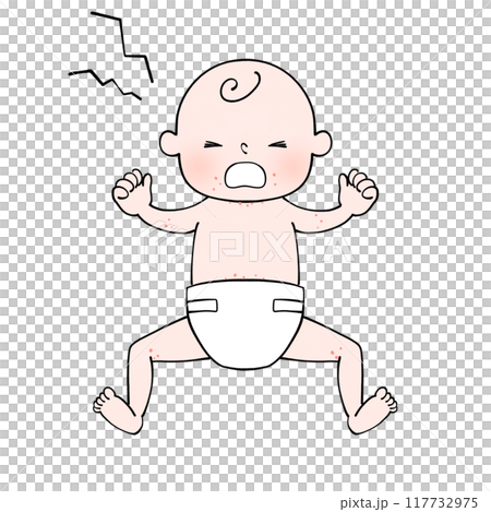 Rash - Illustration of a baby wearing a diaper 117732975