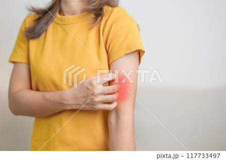 woman itching and scratching itchy arm. Sensitive Skin Allergic reaction to insect bite, food, drug dermatitis. Dermatology, Leprosy day, Systemic lupus erythematosus, Allergy symptoms and rash Eczema woman itching and scratching itchy arm. Sensitive Skin Allergic reaction to insect bite, food, drug dermatitis. Dermatology, Leprosy day, Systemic lupus erythematosus, Allergy symptoms and rash Eczema 117733497