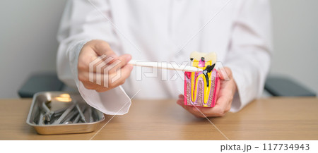 Dentist with tooth Anatomy model. Oral Teeth decay and disease, Scrape off tartar. March Oral health, Dentist Day, False Teeth. Toothache and Children Dental Health Month and Orthodontic Health Day Dentist with tooth Anatomy model. Oral Teeth decay and disease, Scrape off tartar. March Oral health, Dentist Day, False Teeth. Toothache and Children Dental Health Month and Orthodontic Health Day 117734943