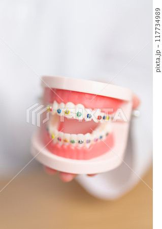 Dentist with Orthodontic tooth model and bracket or brace. Clean and Scrape off tartar. May Orthodontic Health Day, March Oral health, Dentist Day, False Teeth. Toothache and Children Dental Health 117734989