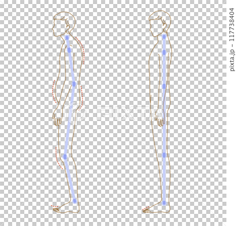 Illustration set of floating toes and normal soles (poor posture of a man's whole body) 117738404