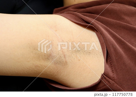 女性の、しばらく処理されていない腋毛 女性の、しばらく処理されていない腋毛 117750778