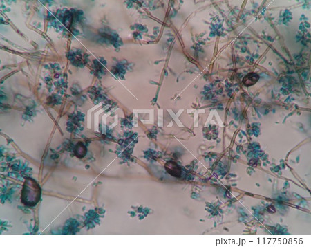 黒かびの分生子の顕微鏡写真 黒かびの分生子の顕微鏡写真 117750856