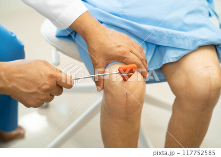 Doctor neurologist testing reflex knee with hammer and show Asian senior scars surgical total knee joint replacement. Doctor neurologist testing reflex knee with hammer and show Asian senior scars surgical total knee joint replacement. 117752585