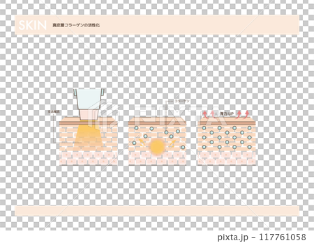 高頻治療活化真皮層膠原蛋白示意圖 117761058