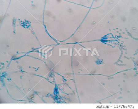 ペニシリウム属のカビ ペニシリウム属のカビ 117768475