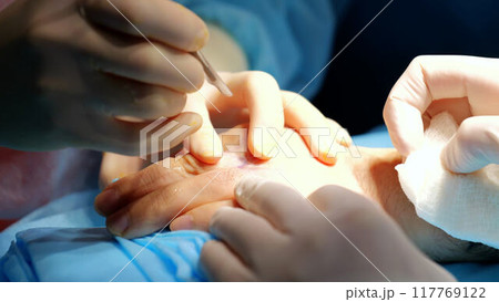 Team of surgeons medical professionals execute surgical intervention modern clinic close up. Significance of teamwork and innovation in contemporary healthcare advanced facilities techniques medicine. 117769122