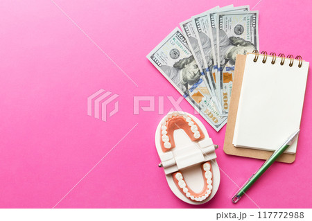 Flat lay composition with educational dental typodont model and money with notebook on colored table, top view. Expensive treatment 117772988