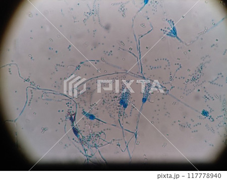 ペニシリウム属のカビの顕微鏡写真 117778940