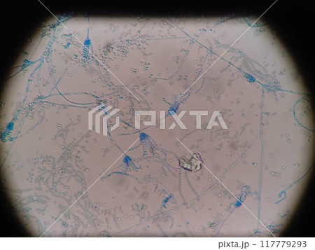 青く染色したアオカビの顕微鏡写真 青く染色したアオカビの顕微鏡写真 117779293