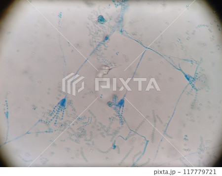 ペニシリウム属のカビの顕微鏡写真 ペニシリウム属のカビの顕微鏡写真 117779721