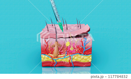 Abstract illustration of a subcutaneous injection Abstract illustration of a subcutaneous injection 117784832