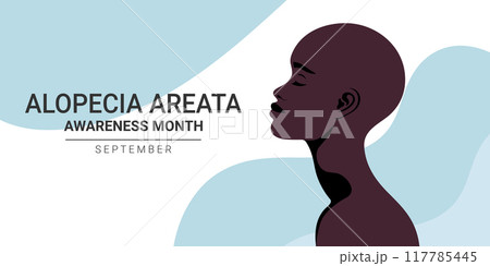 Alopecia Areata awareness month banner. Beautiful African bald woman. Vector illustration 117785445