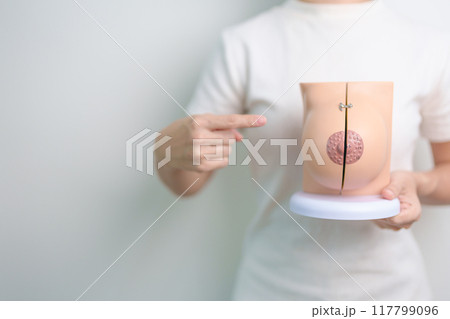 woman holding Breast Anatomy model. Breast Augmentation Surgery, October Breast Cancer Awareness month, implant, Diagnosis, Beauty woman enlargement and medical education concept 117799096