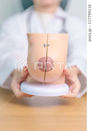 Doctor with Breast Anatomy model. Breast Augmentation Surgery, October Breast Cancer Awareness month, implant, Diagnosis, Beauty woman enlargement and medical education concept 117799116