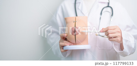 Doctor holding Breast Anatomy model. Breast Augmentation Surgery, October Breast Cancer Awareness month, implant, Diagnosis, Beauty woman enlargement and medical education concept 117799133