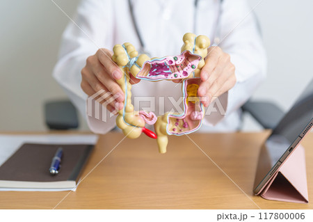Doctor with human Colon anatomy model and tablet. Colonic disease, Large Intestine, Colorectal cancer, Ulcerative colitis, Diverticulitis, Irritable bowel syndrome and Digestive system Doctor with human Colon anatomy model and tablet. Colonic disease, Large Intestine, Colorectal cancer, Ulcerative colitis, Diverticulitis, Irritable bowel syndrome and Digestive system 117800006