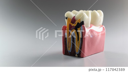 Teaching model of a tooth in cross section, close-up Teaching model of a tooth in cross section, close-up 117842389
