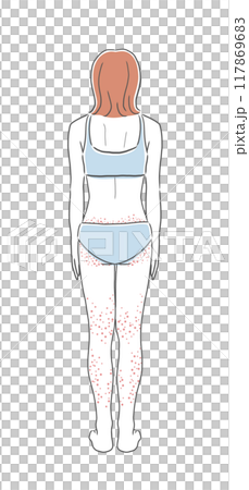 下半身皮膚粗糙的女人背後插畫素材 117869683