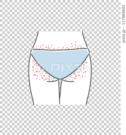 Illustration material of a woman's buttocks with rough skin (bumps) 117869685