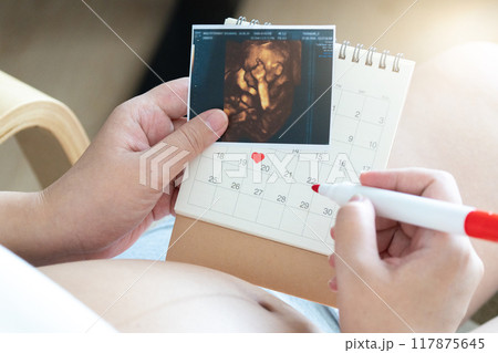 Pregnant women should prepare for childbirth by attending prenatal classes, packing a hospital bag, and arranging transportation. It essential to have a birth plan, ensure all necessary documents 117875645