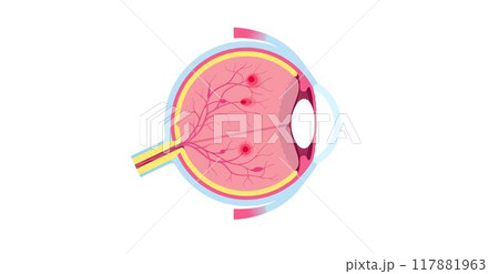 Diabetes related retinopathy 117881963
