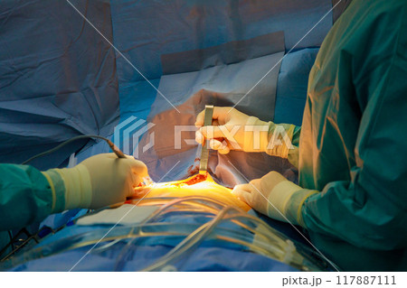 Doctor prepares patient for surgery on operating table in hospital operating room before performing surgery 117887111