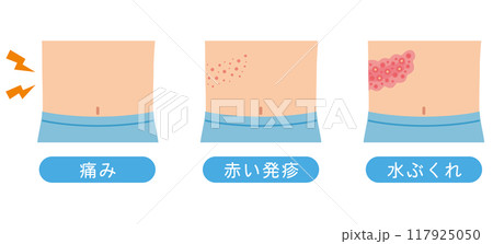 帯状疱疹の症状　医療 117925050