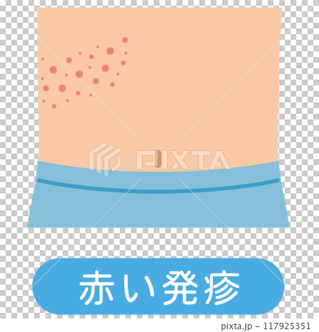 Shingles symptoms medical Shingles symptoms medical 117925351