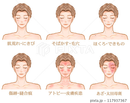 皮膚疾患と肌荒れする大人男性のイラスト素材セット2 117937367