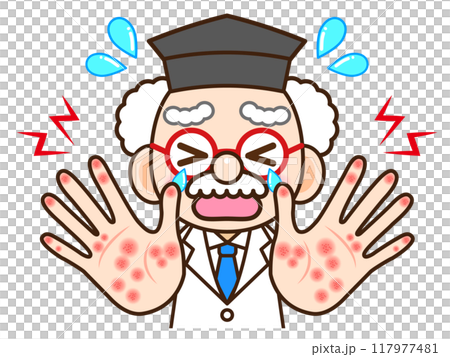 Illustration material of a doctor suffering from eczema and chapped hands due to a rash caused by chemicals 117977481