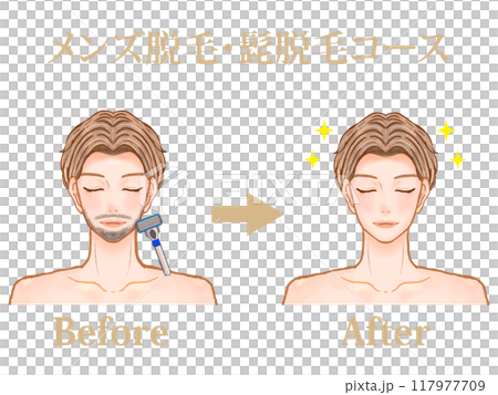 Illustration material of an adult man before and after undergoing men's hair removal at a men's beauty salon Illustration material of an adult man before and after undergoing men's hair removal at a men's beauty salon 117977709