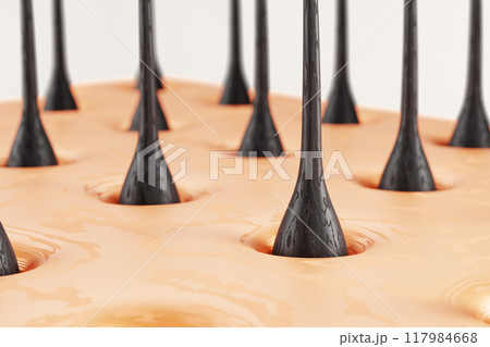 3d damaged hair, dry scalp skin with follicles for micro diagnosis and treatment render background. Thinning, brittle and hair loss concept. Dermatology and trichology mockup banner. 3D illustration 3d damaged hair, dry scalp skin with follicles for micro diagnosis and treatment render background. Thinning, brittle and hair loss concept. Dermatology and trichology mockup banner. 3D illustration 117984668