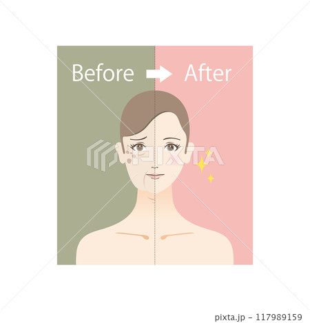 美容のイラスト 老け顔に悩む女性のビフォーアフター 美容のイラスト 老け顔に悩む女性のビフォーアフター 117989159