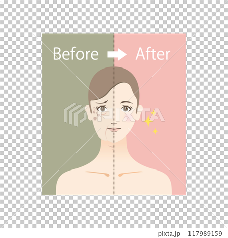 美容のイラスト 老け顔に悩む女性のビフォーアフター 美容のイラスト 老け顔に悩む女性のビフォーアフター 117989159