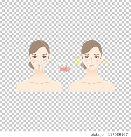Beauty illustration: Before and after of a woman suffering from a mole 117989167