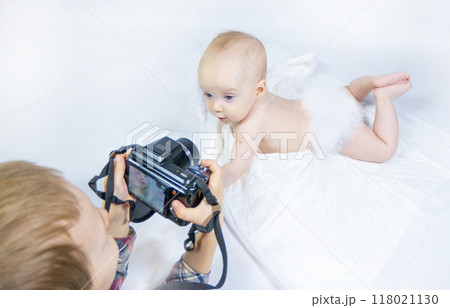 a baby with a hemangioma on his neck lies on a white background a baby with a hemangioma on his neck lies on a white background 118021130