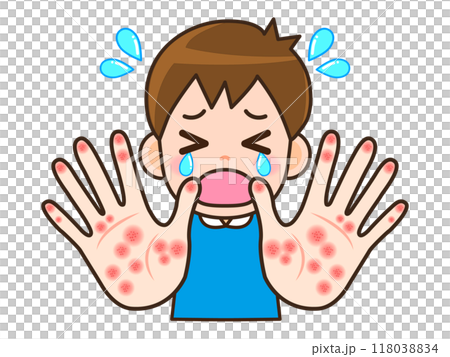 手湿疹と手荒れに苦しむ男性のイラスト素材 118038834