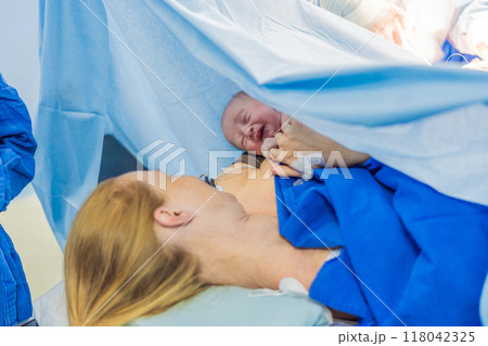 Baby on mother's chest immediately after birth in a hospital. The mother and newborn share a tender moment, emphasizing the bond and emotional connection. The medical staff ensures a safe and caring 118042325